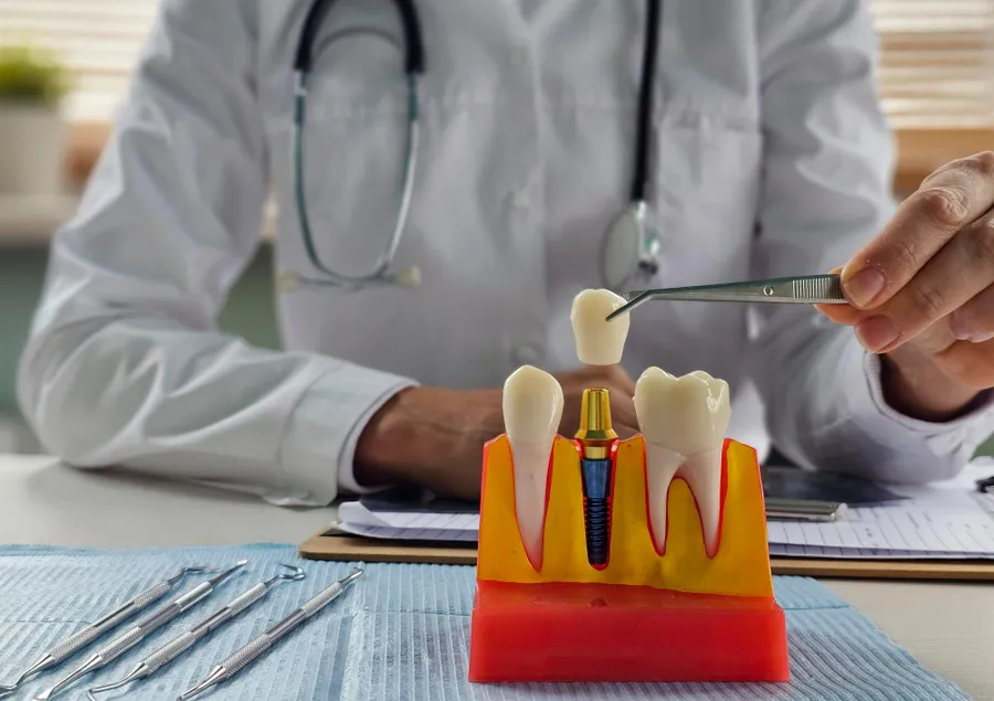 Dental Implants in Turkey: Cost, Safety and What to Expect