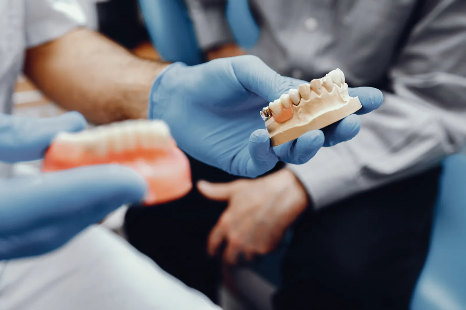 All-on-6 Full-Arch Treatment