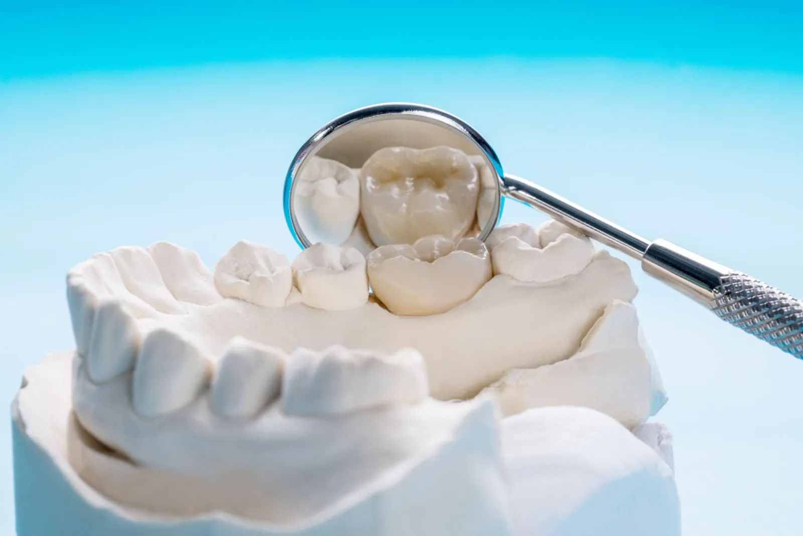 Dental Crowns
