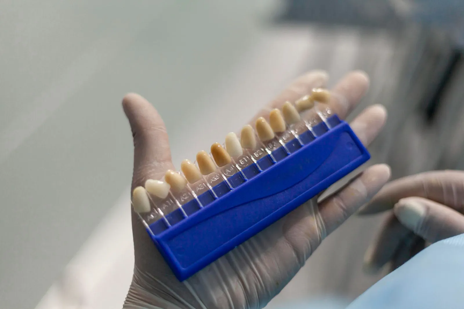 Dental Veneers