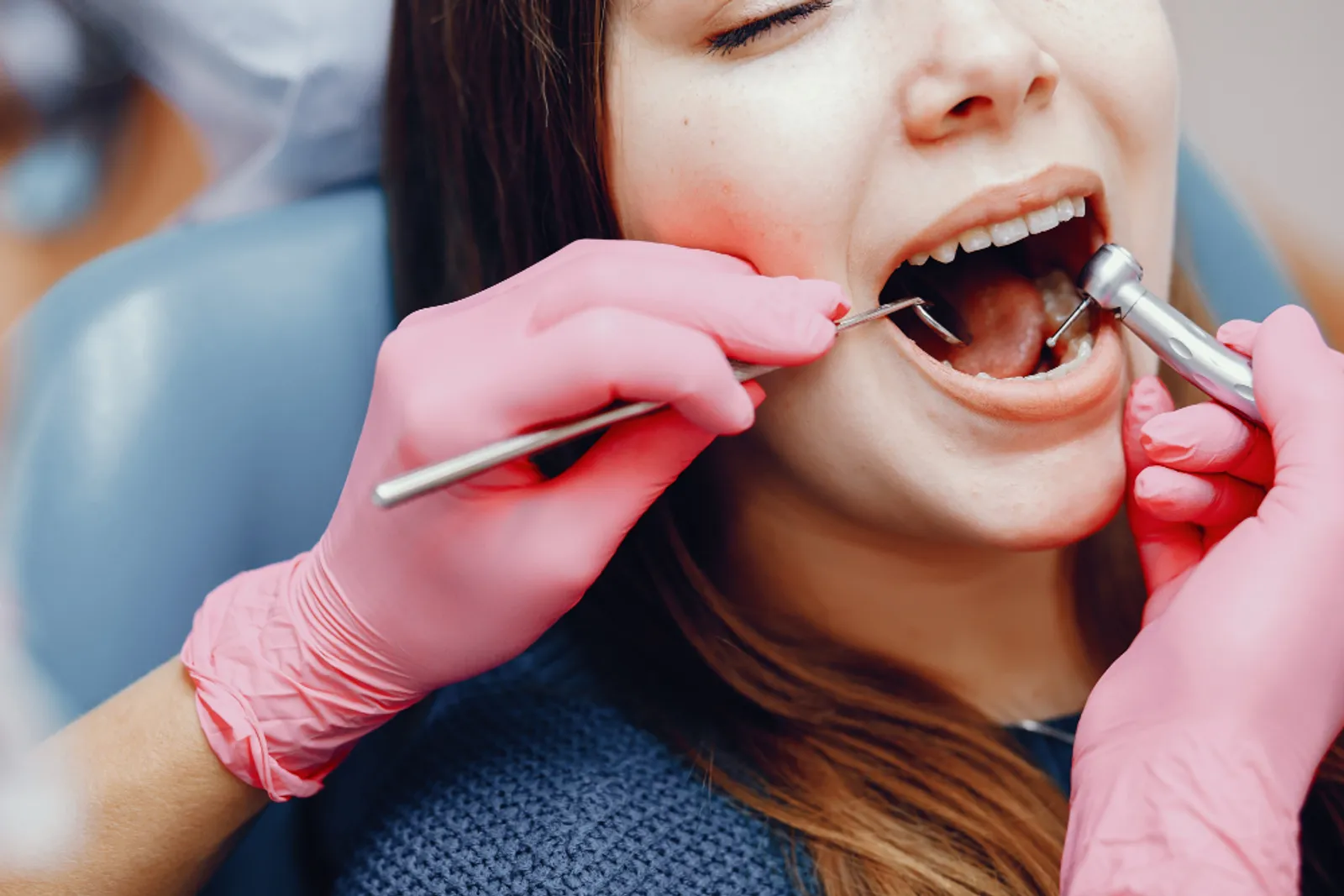 Tooth Filling