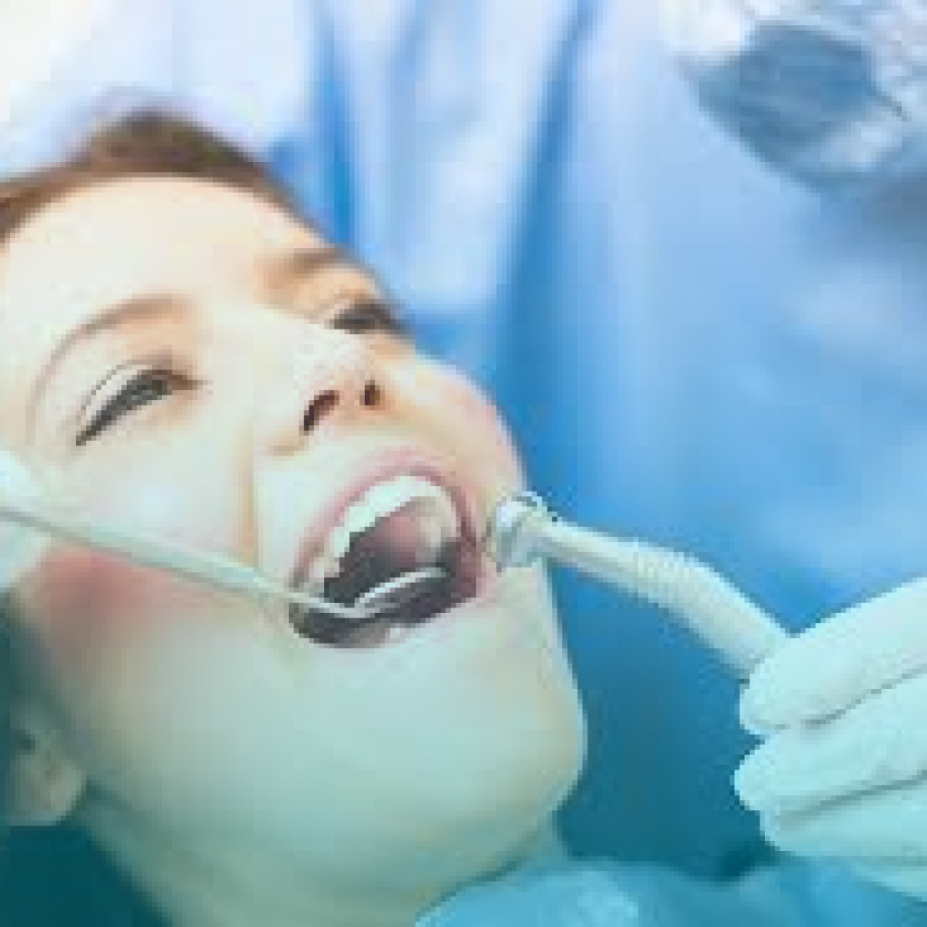 Dental Veeners 1 2 Procedures