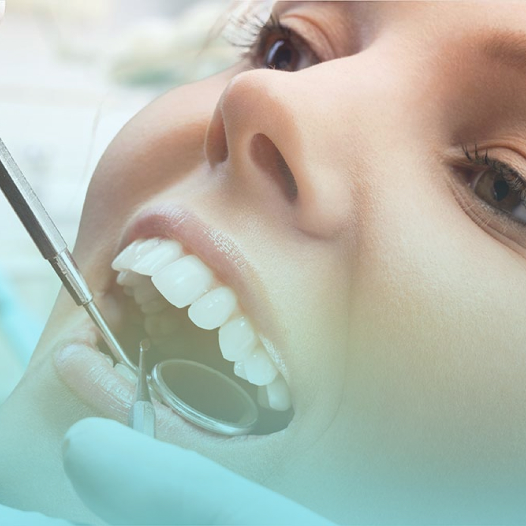 Dental Veeners 1 5 Procedures