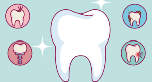 Freddie Mercury Teeth, a teeth image