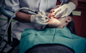 Freddie Mercury teeth, dental operation