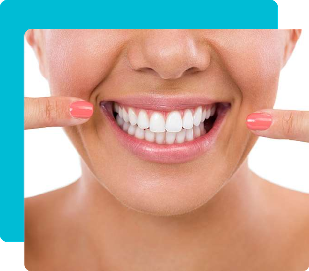 Group 5 25 Gum Contouring in Turkey