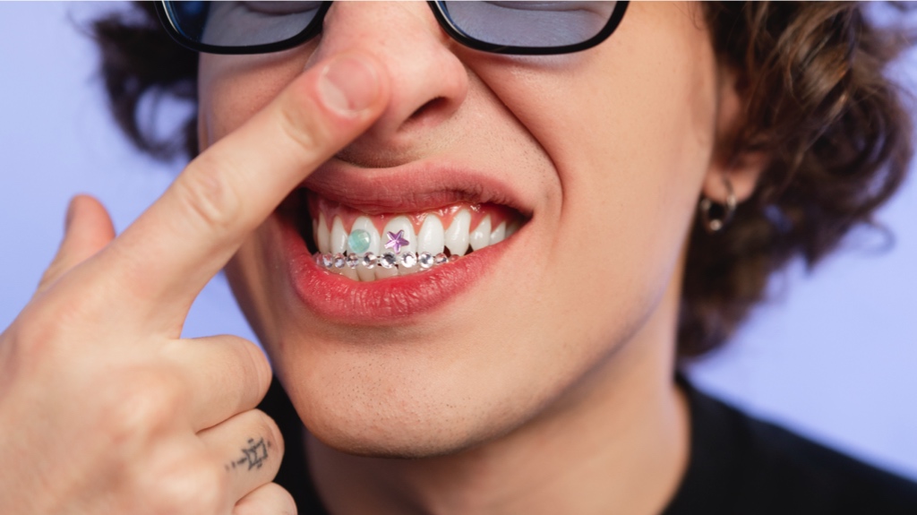 IMG 6875 Veneers Before and After - The Hollywood Smile